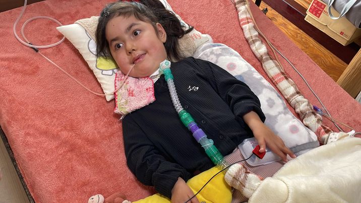 成人発症の脊髄性筋萎縮症の症状は何ですか?